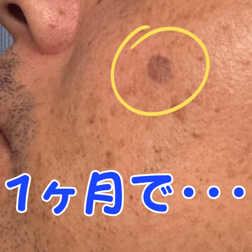 美顔スキンケア後