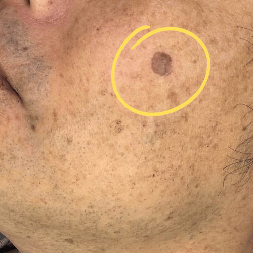 美顔スキンケア前