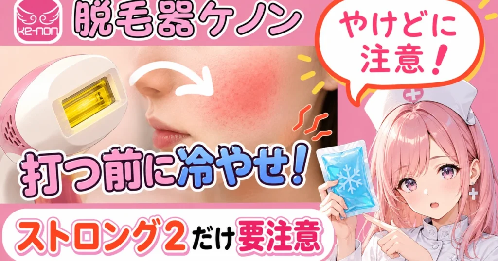 ケノンのやけど注意と冷却を説明するアイキャッチ