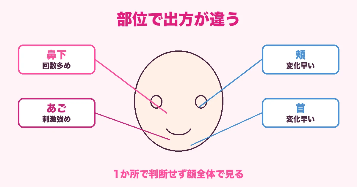 ヒゲの部位ごとに効果の出方が違うことを示す顔の図