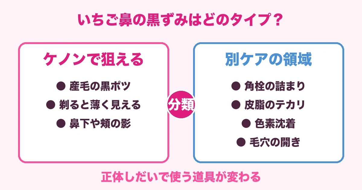 いちご鼻の黒ずみをケノンで狙える産毛タイプと別ケアが必要なタイプに分類した図