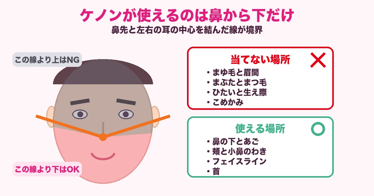 ケノンの照射が使える顔の範囲を示した図