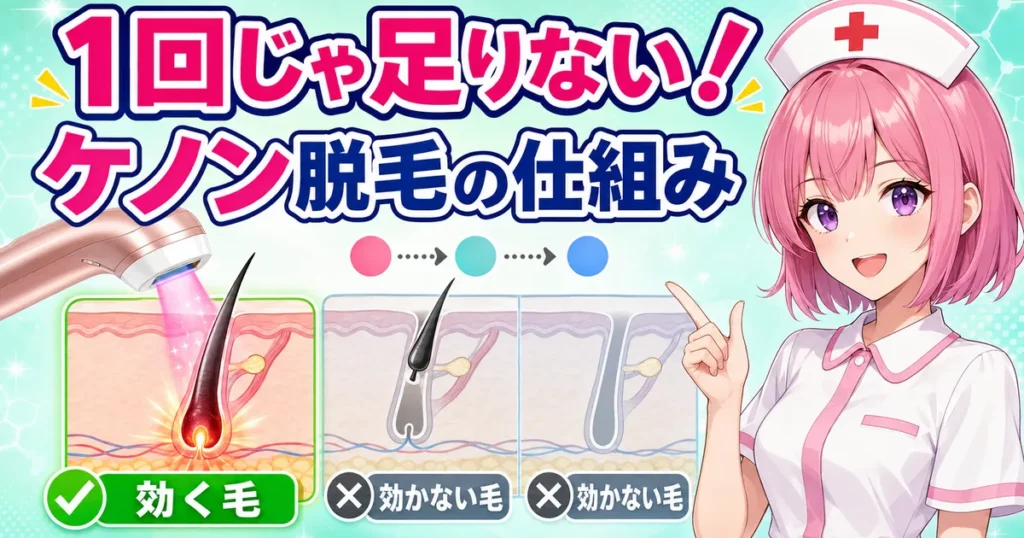 ケノンの脱毛の仕組みを解説するけのんちゃん