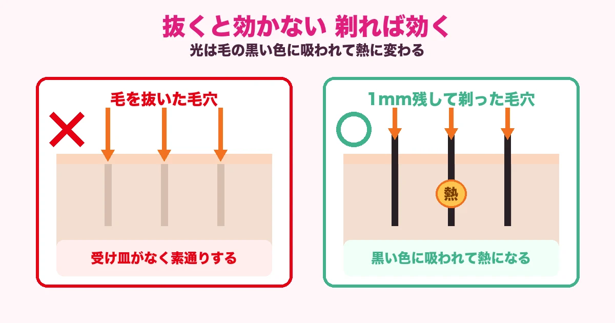 ケノンは毛を抜くと光が効かず1mm残して剃ると熱に変わる