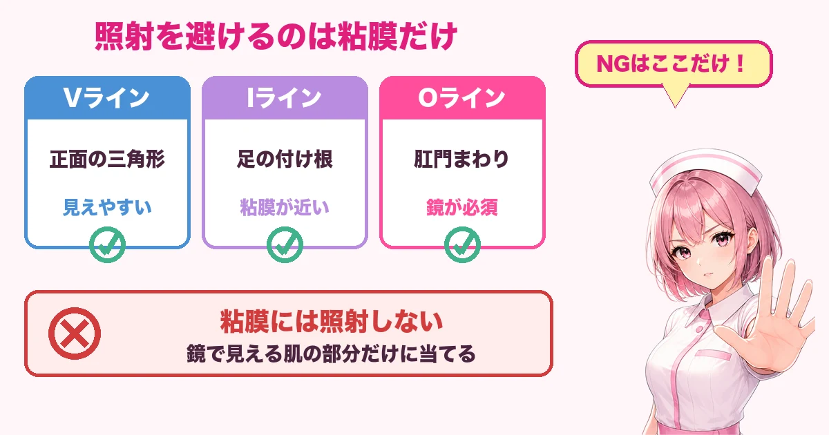 VラインIラインOラインの範囲と粘膜だけが照射NGであることを示す図