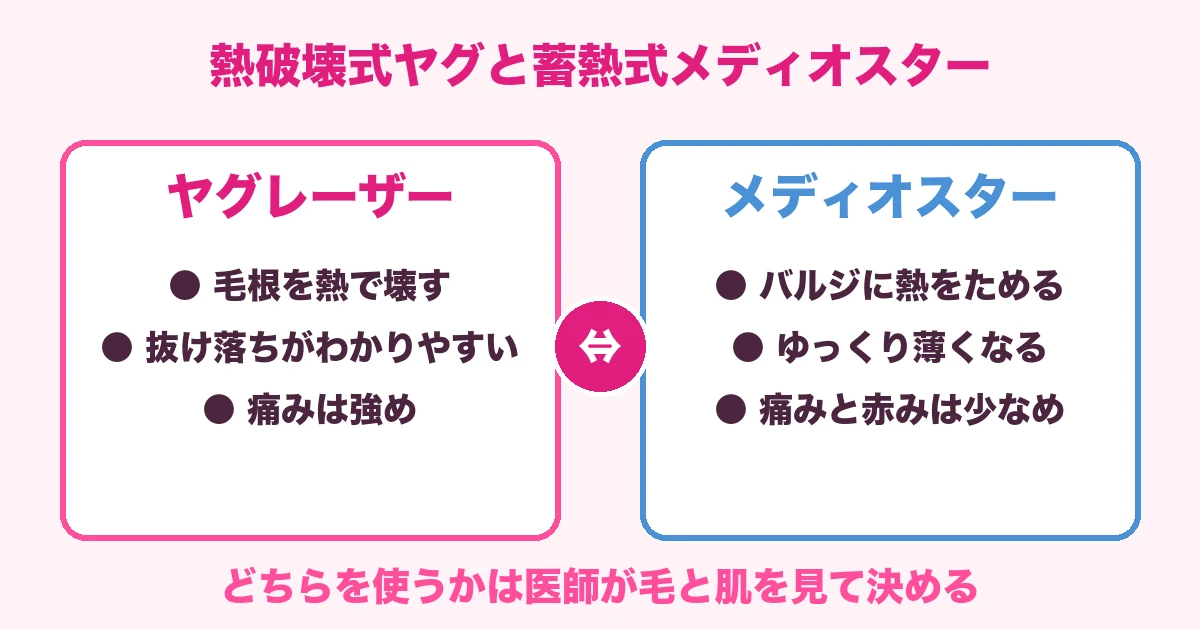 熱破壊式ヤグと蓄熱式メディオスターの違い