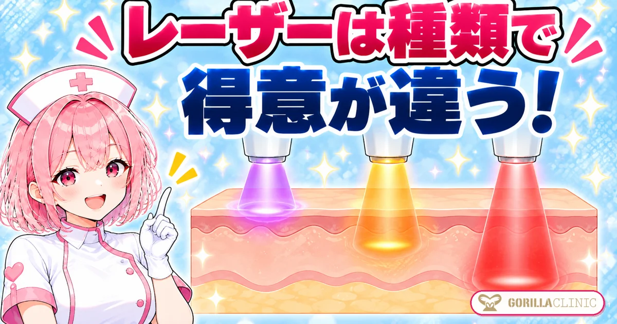 レーザーは種類で得意が違う