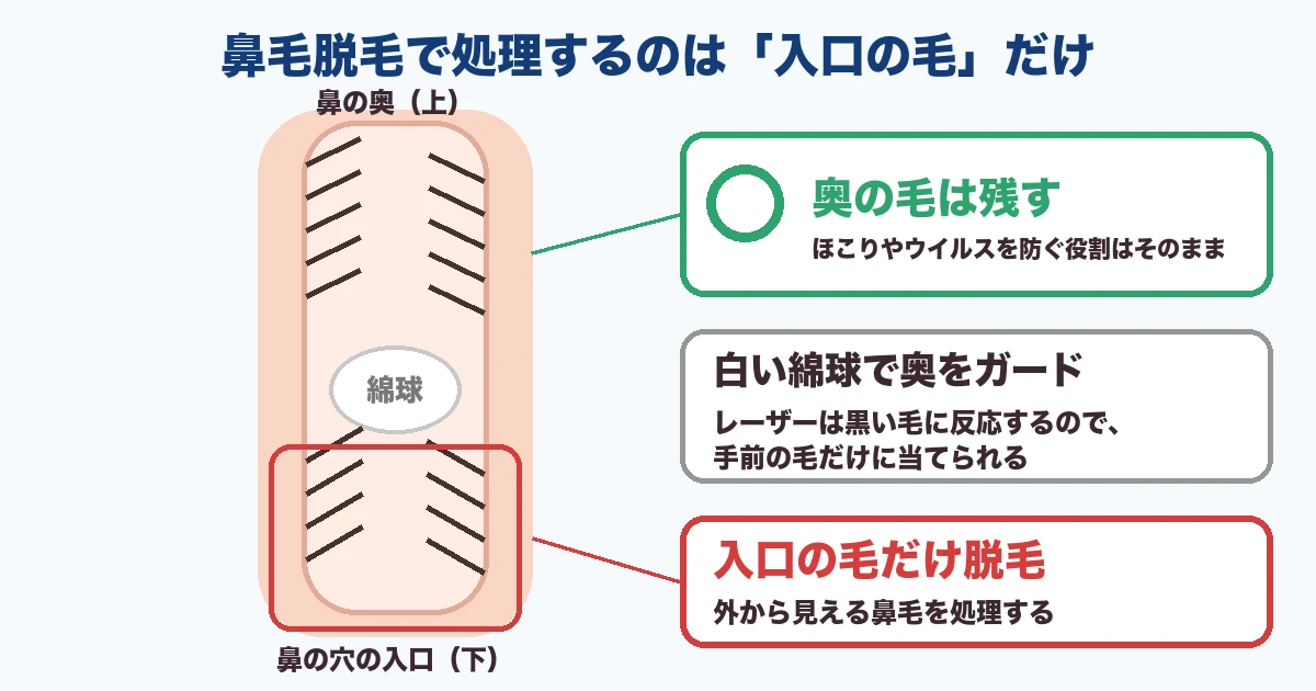 鼻毛脱毛で処理するのは入口の毛だけ・奥の毛は残す