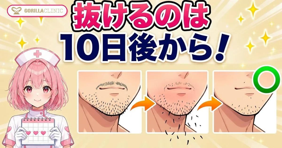 ヒゲが抜けるのは照射の10日後から
