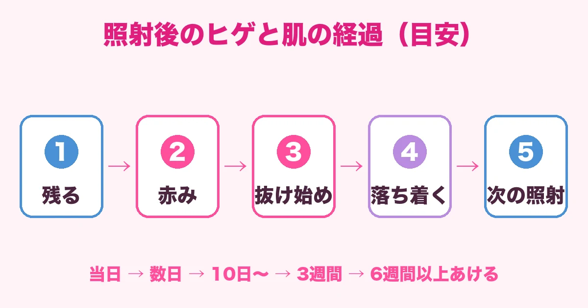 照射後のヒゲと肌の経過の目安