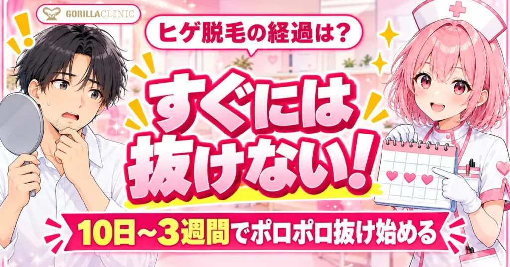 ゴリラクリニックのヒゲ脱毛の経過はすぐには抜けない 10日〜3週間でポロポロ抜け始める