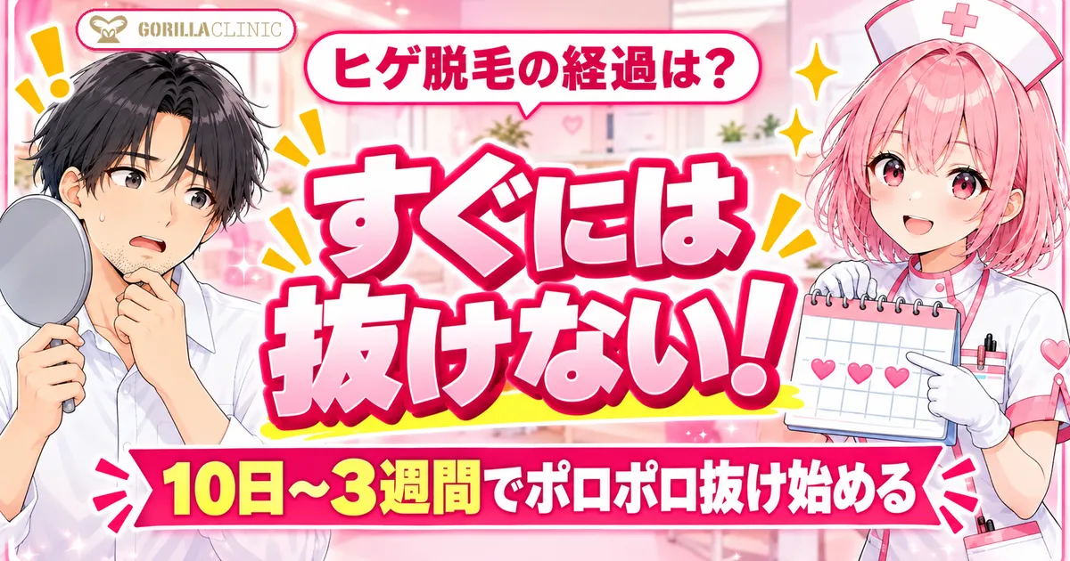 ゴリラクリニックのヒゲ脱毛の経過はすぐには抜けない 10日〜3週間でポロポロ抜け始める